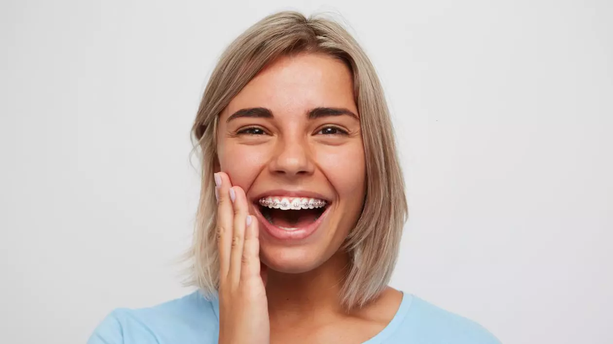 (Publicitate) 10 mituri despre aparatul dentar