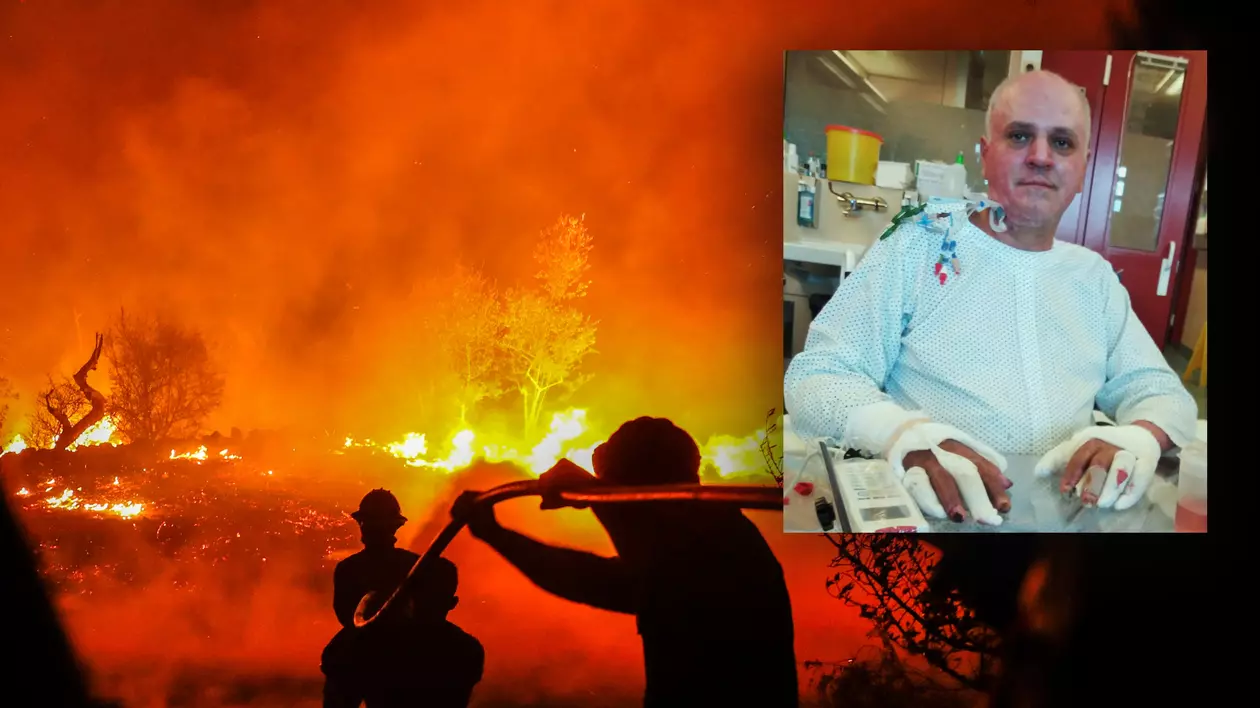 Ministerul Sănătăţii neagă că  pompierul ars în incendiul din Mehedinți e tratat în două spitale, dar admite că face naveta între ele! La intervenție, Mihai Sfetcu s-a luptat cu focul îmbrăcat în echipament vechi de 13 ani, cu sac stingător și lopată