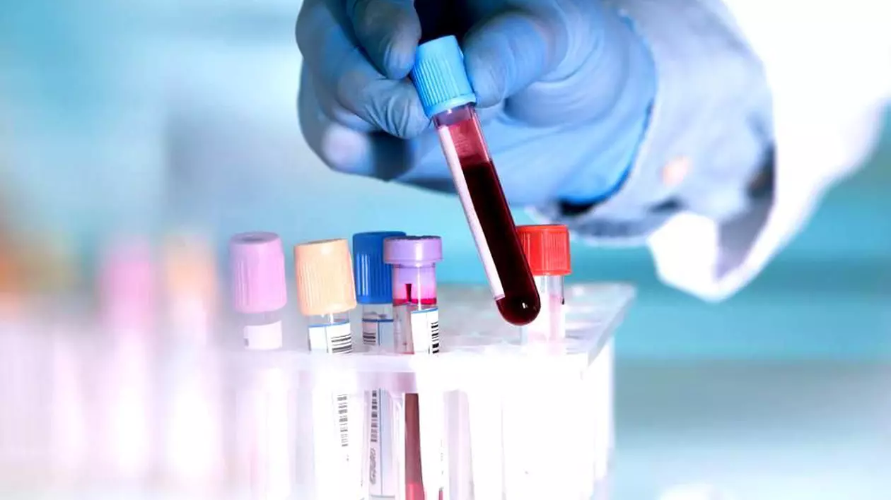 Un test de sânge ar putea depista cancerul cu patru ani înainte de apariția primelor simptome