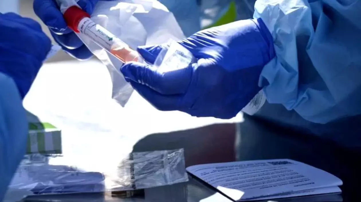 COVID-19 a devenit a treia cauză de deces în Statele Unite ale Americii