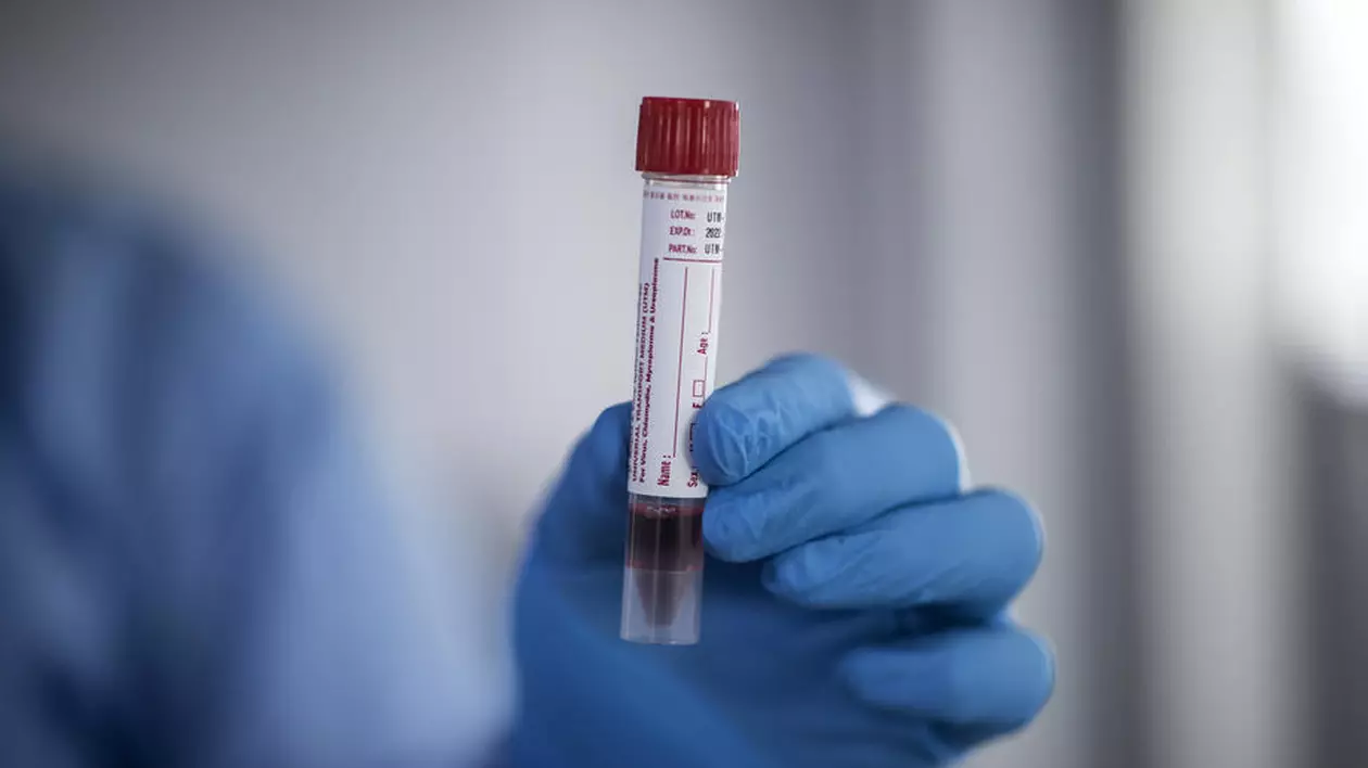 Un test negativ COVID-19 nu înseamnă neapărat că suntem în siguranță. Până la 30% dintre teste pot fi fals negative