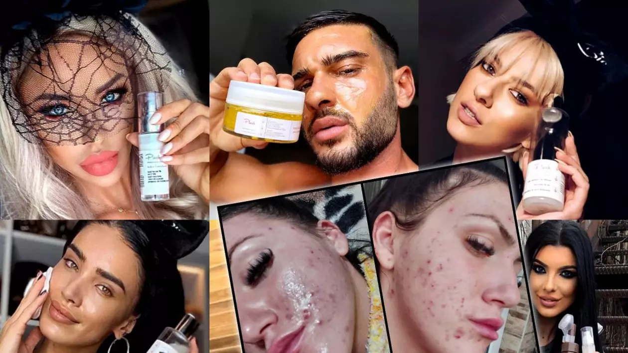 Deși zeci de tinere au acuzat că le-au distrus tenul, influenceri și vedete nu se dezic de produsele Plush Bio. Dorian Popa e cel mai vehement apărător, dar nu a folosit cremele cu probleme