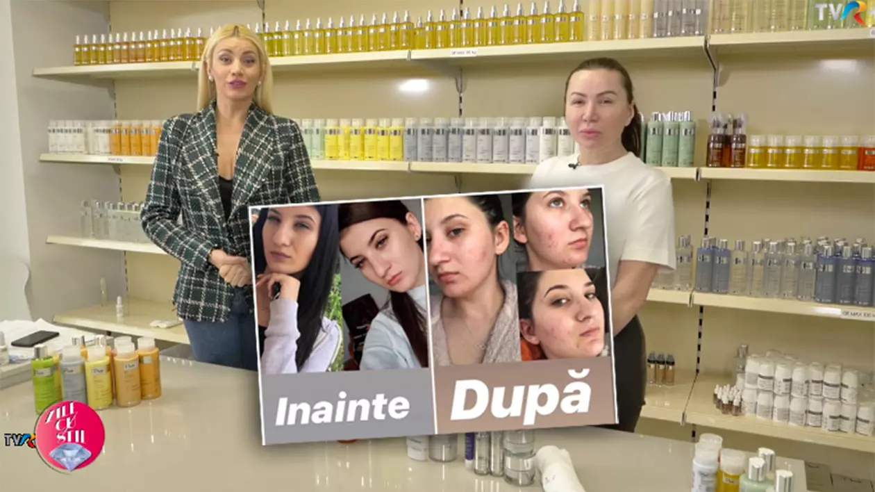 Opt luni de la scandalul Plush Bio. Niciun vinovat, tinere care nu au fost chemate la audieri, produse pentru ten promovate la TVR