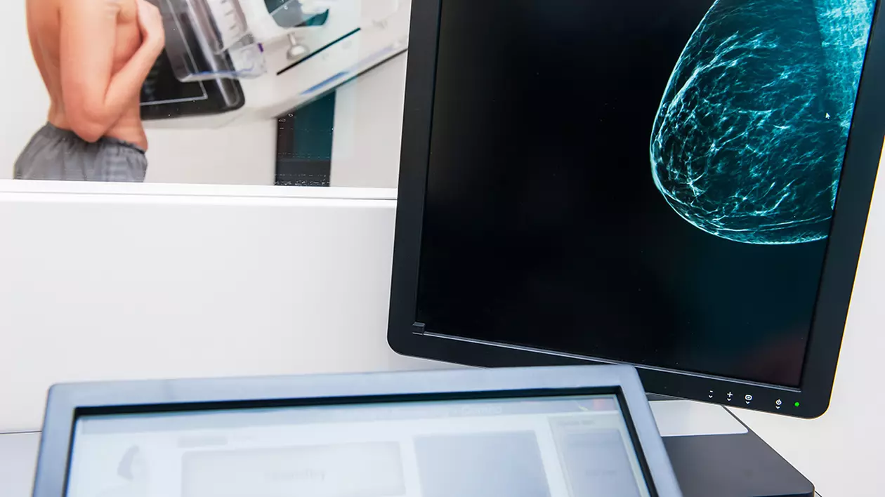 Peste 70.000 de femei au fost amânate la screeningul cancerului la sân. Cum a afectat pandemia managementul cancerului