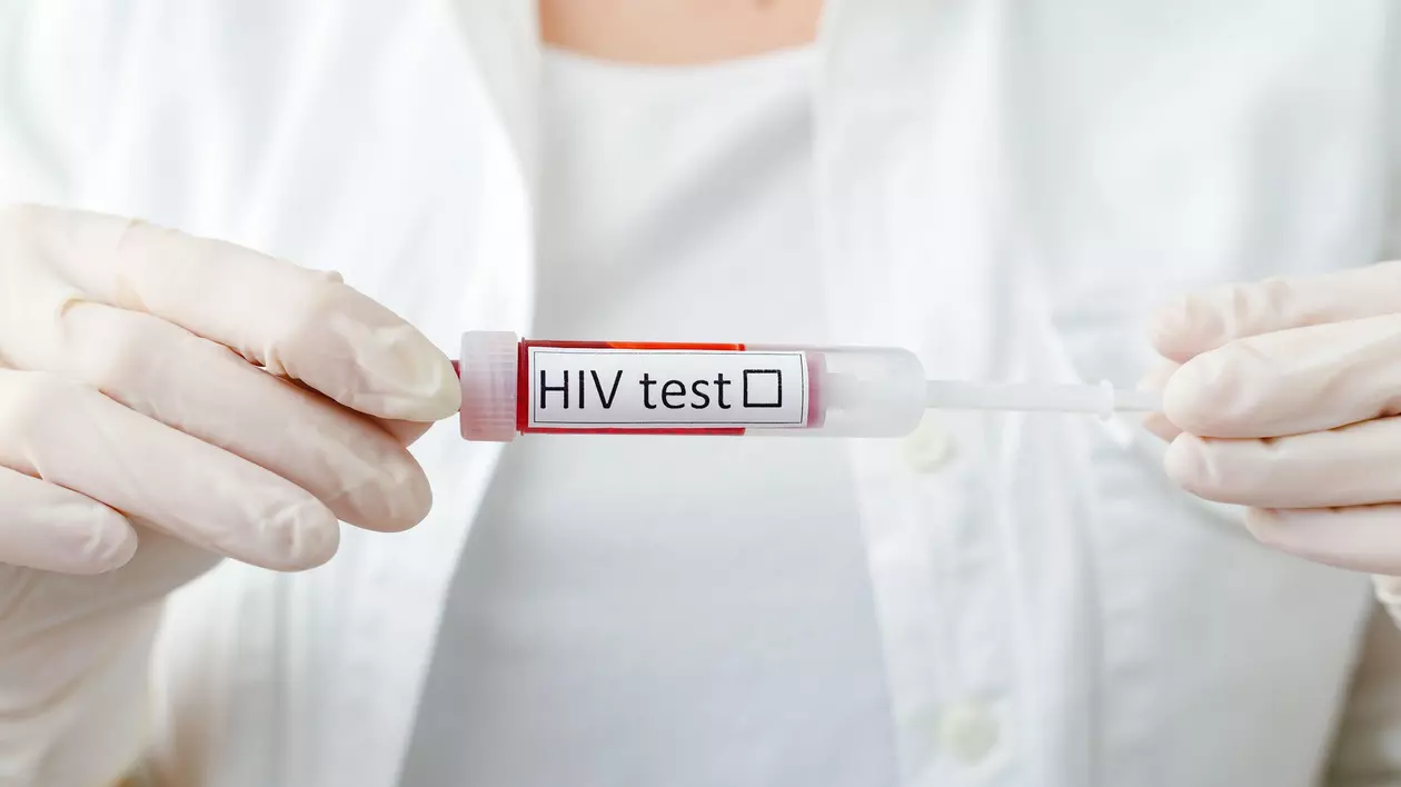 ﻿Pandemia COVID a agravat situaţia HIV în România. Rata de testare s-a prăbușit, numărul infectărilor a crescut