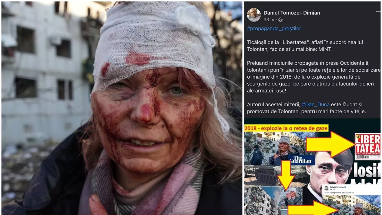 Femeia rănită în Ucraina, despre care Sputnik și un jurnalist de la Radio China spuneau că nu există, a vorbit pentru Libertatea: „Am fost victima unui atac cu rachetă”