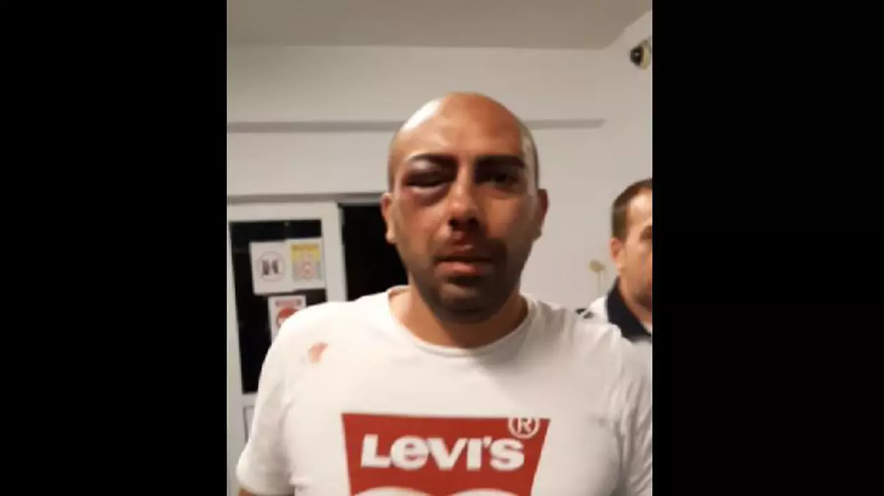 Un bărbat din Piatra Neamț acuză că a fost bătut în secția de poliție. Parchetul a deschis dosar penal
