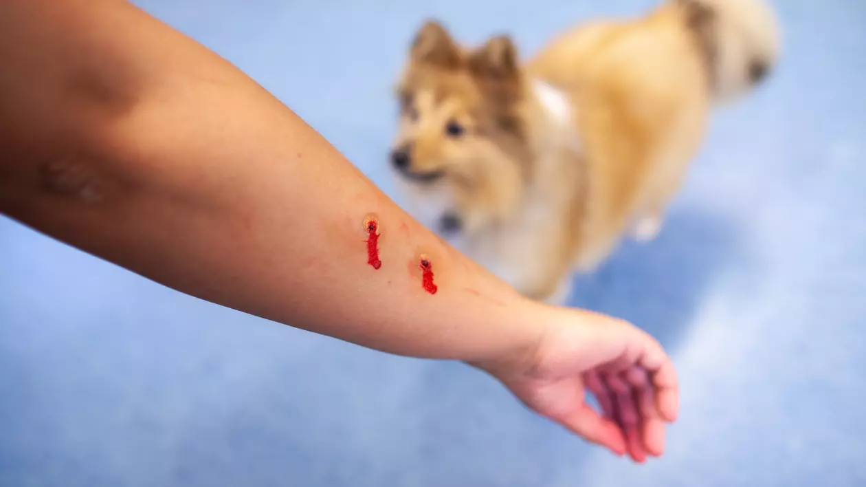 Primul ajutor în cazul unei mușcături de câine - Imagine cu mâna muşcată de un câine a unei persoane alături de un câine de talie mică