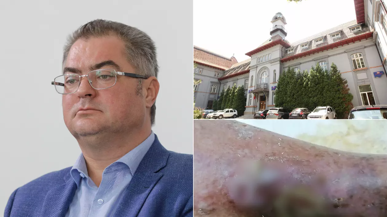 Managerul de la „Obregia” dă vina pe pacient pentru viermii dezvoltați în plăgi, deși acesta era internat de 10 zile