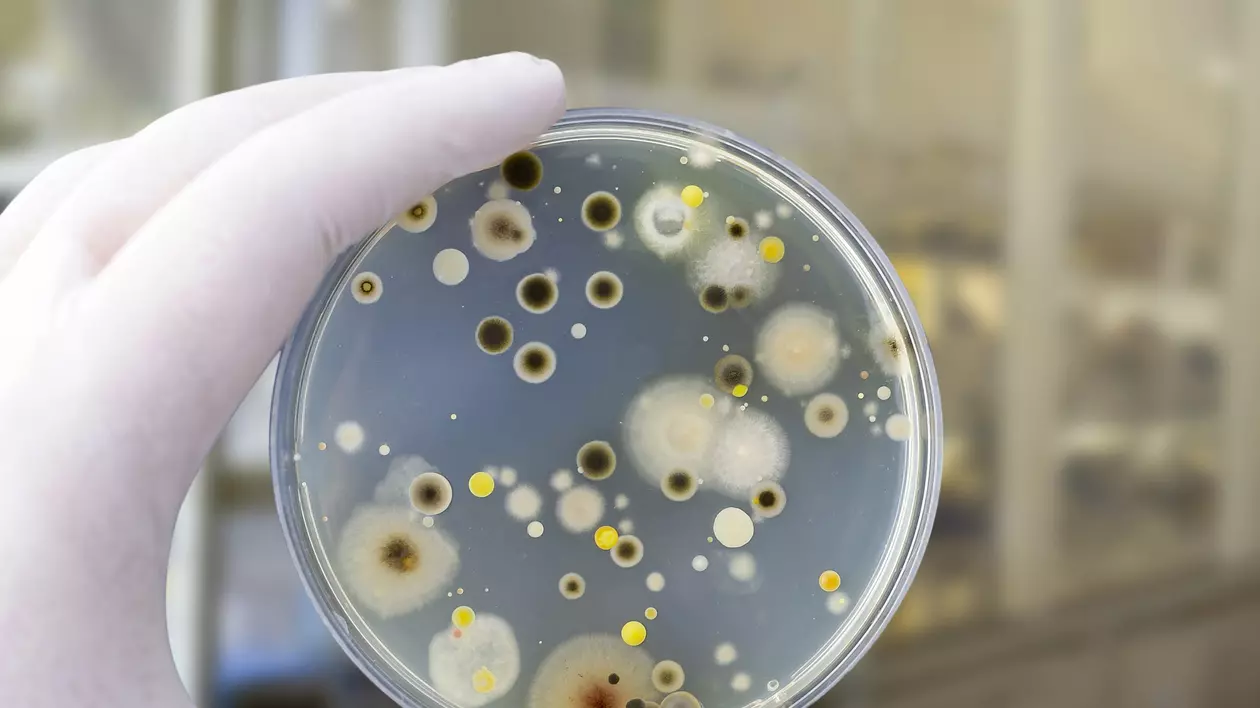 Cele mai periculoase bacterii care pot contamina alimentele