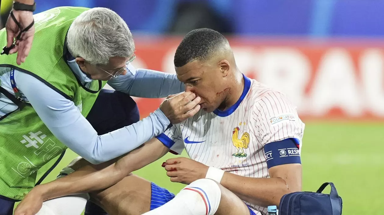 EURO 2024 | Mbappé, aut cu olandezii, după ce și-a spart nasul în meciul cu Austria, anunță L'Équipe