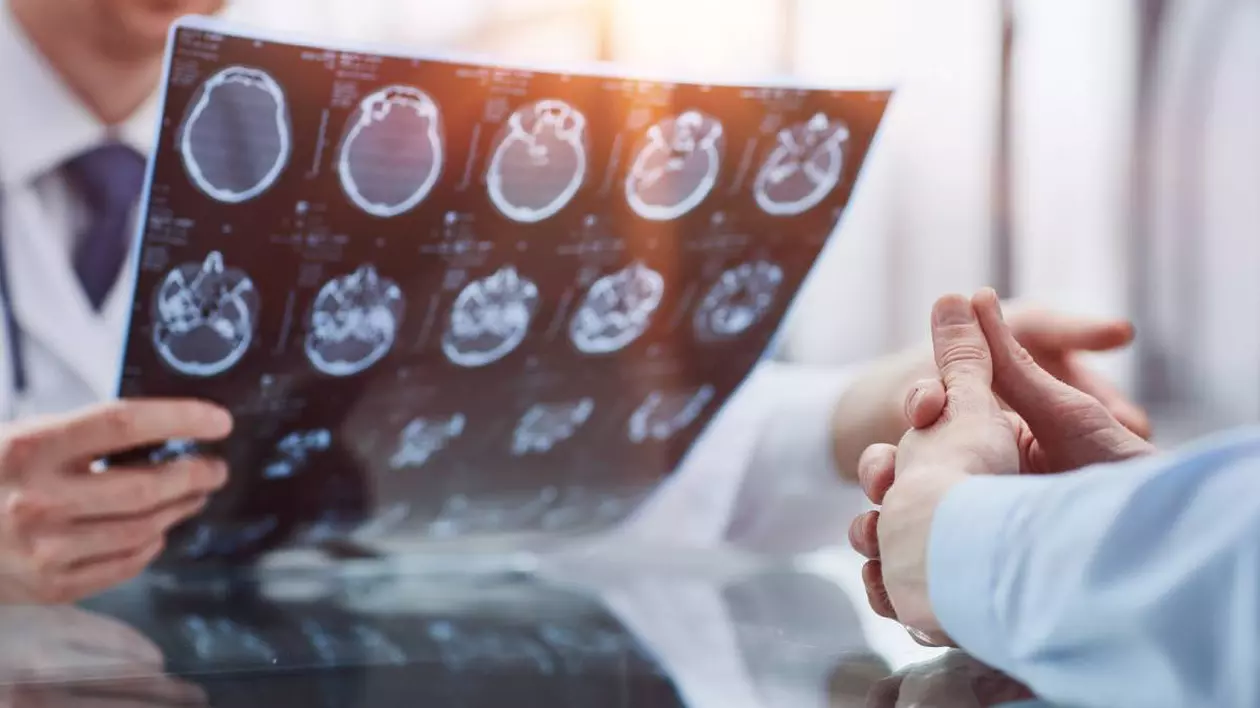 doctor care tine in mana o radiografie cerebrala in fata lui este un pacient care tine mainile impreunate