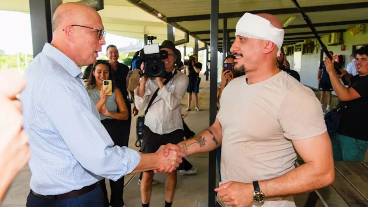 Liderul opoziției din Australia i-a spart capul unui cameraman, după ce l-a lovit din greșeală cu o minge de fotbal australian