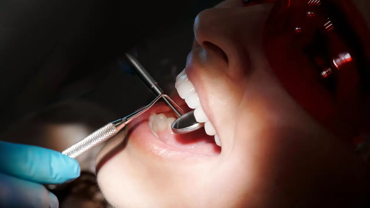 Etapele procedurii de implant dentar – ce trebuie să știi
