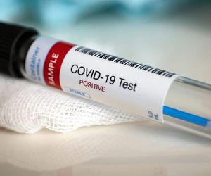 Cercetatorii chinezi au descoperit o noua metoda prin care se poate transmite coronavirusul! Care este aceasta