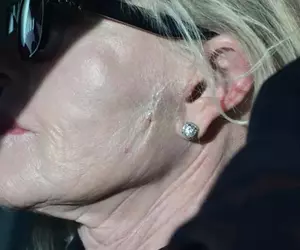 Da, e chiar ea, ne-a lăsat fără cuvinte! Are fața cusută cu fire, iar mâinile sunt pline de vânătăi! A fost de o frumusețe angelică însă azi actrița noastră e complet transformată