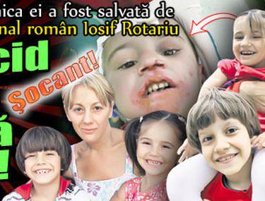 Socant Fata Adoptată De Rotariu Arsă Cu Acid Sulfuric Si Aruncată Pe Geam Fotbal Sport Libertatea Libertatea