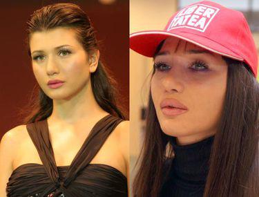 6 Vedete Inainte Si După Mărirea Buzelor Cum Arată Mai Bine Entertainment Monden Libertatea Libertatea