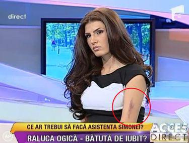 Raluca Ogică Lovită De Iubit In Parc Nu Le Am Spus Părinţilor Mi A Fost Rusine Entertainment Monden Libertatea Libertatea
