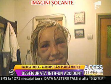 Raluca Podea A Fost Desfigurată Intr Un Accident Rutier Foto Entertainment Monden Libertatea Libertatea