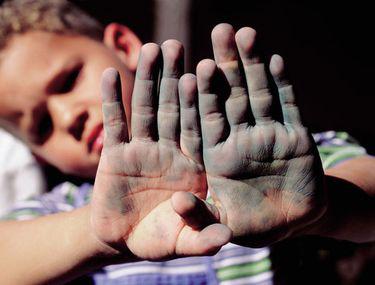 9 feluri in care mainile iti arata ca suferi de anumite boli