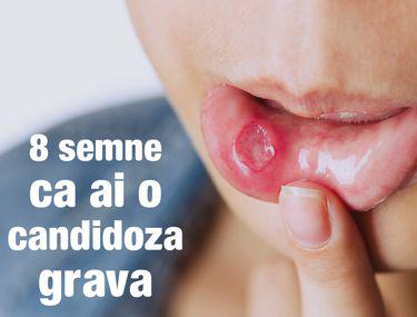 Semne Că Infecția Cauzată De Candida Iți Distruge Organismul Lifestyle Sănătate și Fitness Libertatea Libertatea