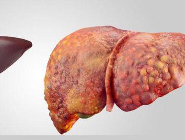 Detoxifiați Regenerați și Intăriți Ficatul Dumneavoastră După Sărbători Libertatea