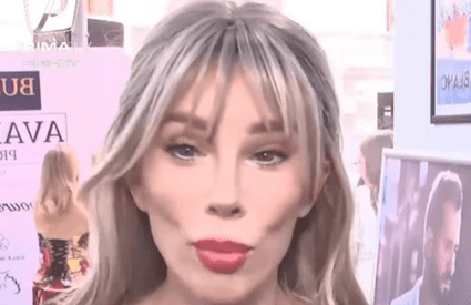 Cum arată vedeta noastră, după ce și-a făcut lifting facial: „Am purtat ochelari de soare în casă să nu sperii copiii”