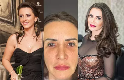 Mara Bănică, răspuns tranșant după operația la față. Imagini incredibile înainte și după: „Cred că sunt un exemplu de lifting facial reușit”