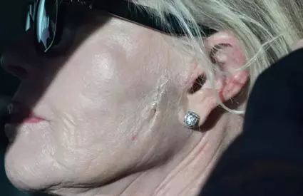 Da, e chiar ea, ne-a lăsat fără cuvinte! Are fața cusută cu fire, iar mâinile sunt pline de vânătăi! A fost de o frumusețe angelică însă azi actrița noastră e complet transformată