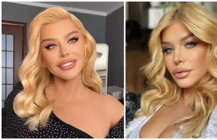 Cum arăta Loredana Groza în anul 1995. Artista susține că nu a apelat la medicul estetician, dar pozele spun altceva