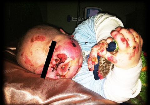 Povestea sfâşietoare a unui copil care nu poate fi ţinut în braţe | ATENŢIE, FOTO ŞOCANT