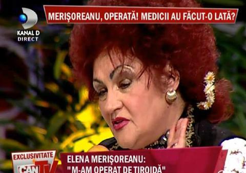 Elena Merişoreanu, CHIN pe masa de operaţie. Au vrut să-i şteargă machiajul, dar n-au ştiut că este permanent
