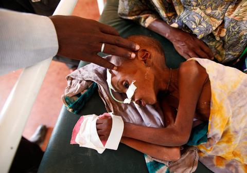 FOAMETEA ameninţă planeta! Omenirea e în pragul unei crize alimentare fără precedent