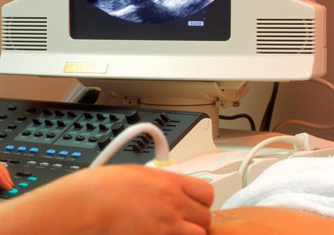 Ieri, pântecele ei era MIRACOLUL LUMII. Azi, lumea află şocată: "UTERUL E GOL!"  