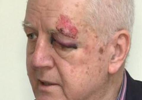 Jean Pădureanu, bătut şi tâlhărit în Bucureşti | VIDEO