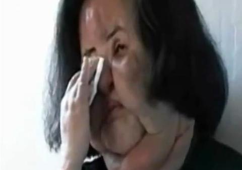 Era o frumuseţe, însă a ajuns un MONSTRU! Vezi cum arăta artista ÎNAINTE de a-şi INJECTA ULEI DE GĂTIT în faţă! VIDEO