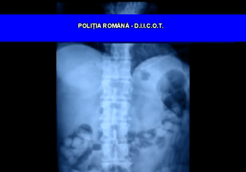 Traficanţi de droguri prinşi la Ploieşti | Ascundeau cocaina în stomac!