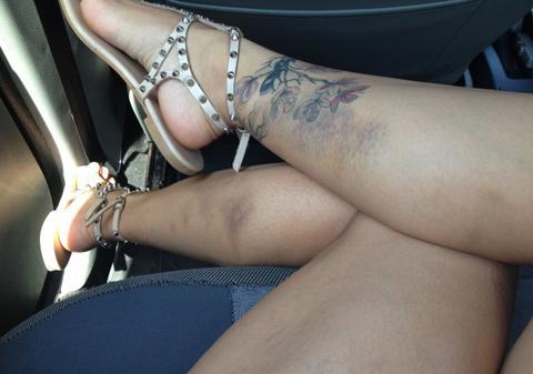 Află de ce e Andreea Popescu plină de vânătăi 