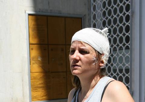 ŞOC! Uite-o pe MAMA VITREGĂ a lui HUIDU, cu BANDAJ pe cap, după ce A FOST TĂIATĂ la URECHE! VIDEO