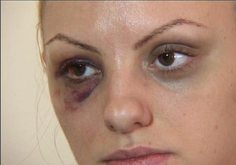 ELE AU FOST "IUBITE" CU PUMNUL! Vezi care sunt VEDETELE BĂTUTE de PARTENERII DE VIAŢĂ