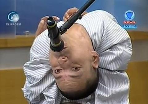 ŞOCANT! Povestea CUTREMURĂTOARE a unui bărbat care s-a născut cu CAPUL RĂSTURNAT pe SPATE. Medicii nu i-au dat NICIO ŞANSĂ de SUPRAVIEŢUIRE | VIDEO