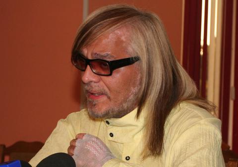 Bolnav de cancer, Marian Dârţă nu şi-a pierdut speranţa: ”Cred că asta este o minune”