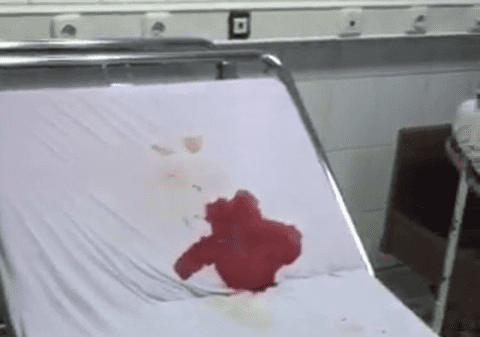 EXCLUSIV/ Încă o poveste revoltătoare a unui copil răpus de rujeolă. Hulitul spital din Reșița, suspectat ca a infectat cu rujeolă o fetiță de doi ani