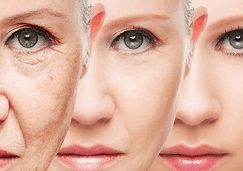 Scapa de riduri folosind revolutionara crema Bioxelan! Afla care este secretul acestui tratament natural!