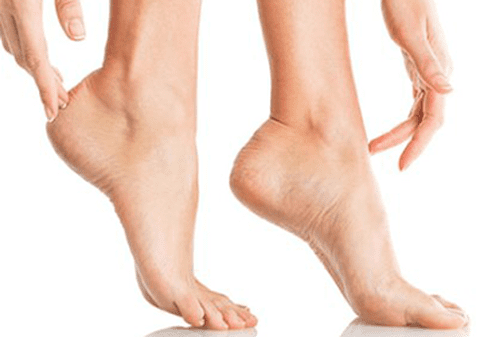 Sa fie Onycosolve cel mai bun tratament natural pentru infectiile fungice?!