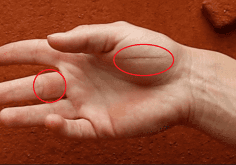 Așa arată palma Simonei Halep, după ce a câștigat primul Mare Șlem. Gloria cere sacrificii