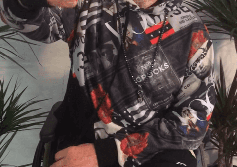 Un rapper german a rămas fără jumătate din craniu din cauza drogurilor