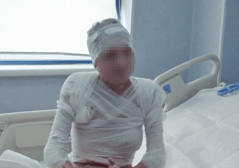 Strigăt de ajutor pentru fata din Mehedinți, incendiată de un criminal. Supraviețuitor Colectiv: “A trecut prin toate formele imaginabile de abuz”