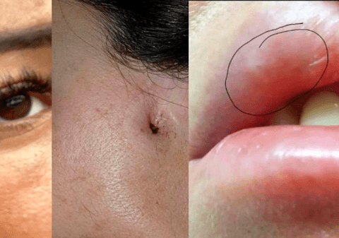 „Dr. Lana”, femeia acuzată că făcea operații estetice fără drept de practică, trimisă în judecată